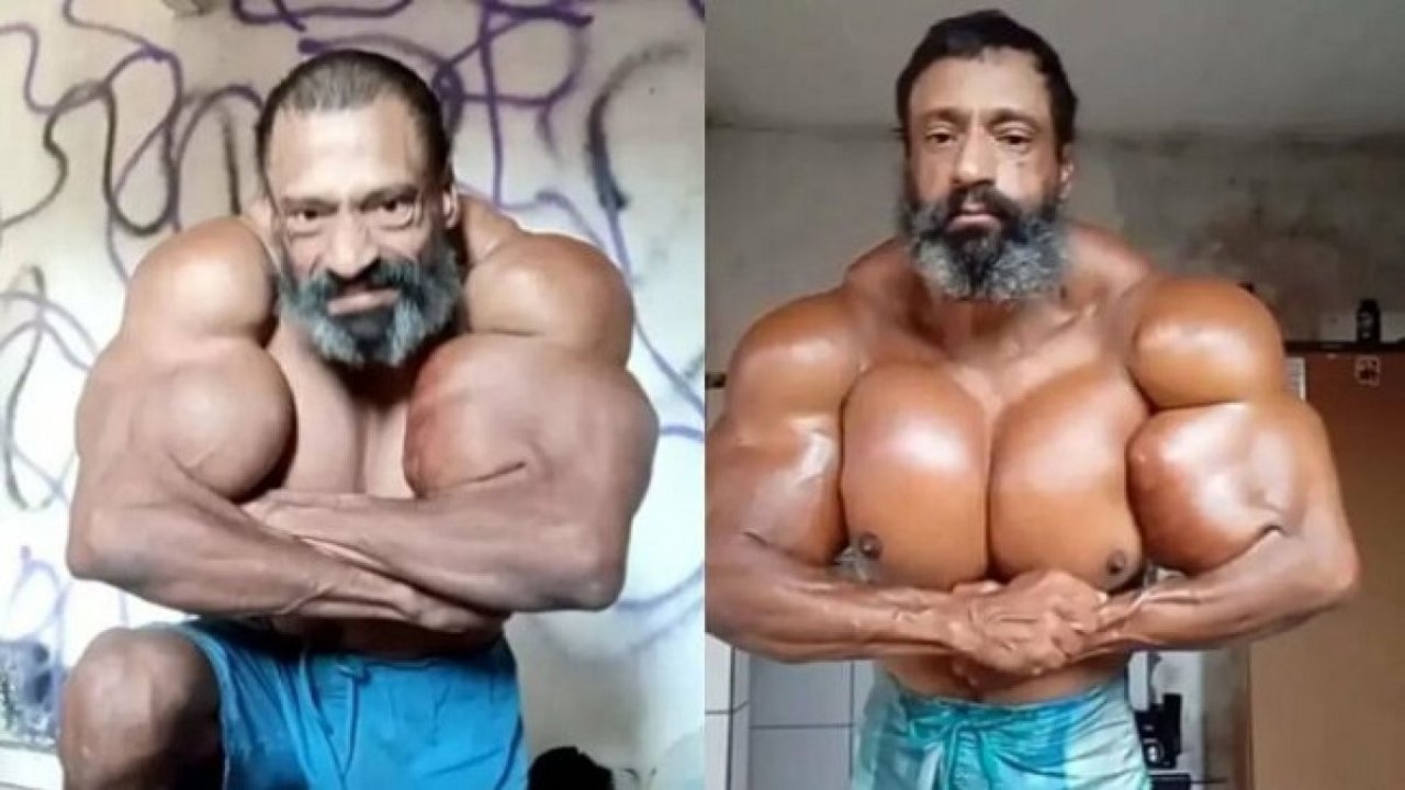 Synthol Man Dies