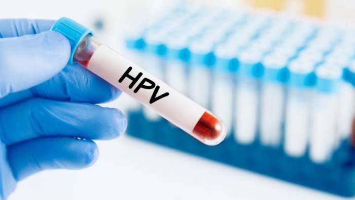 DSÖ : Kanser vakalarının % 95’i HPV kaynaklı. 300 binden fazla kadını öldürdü!