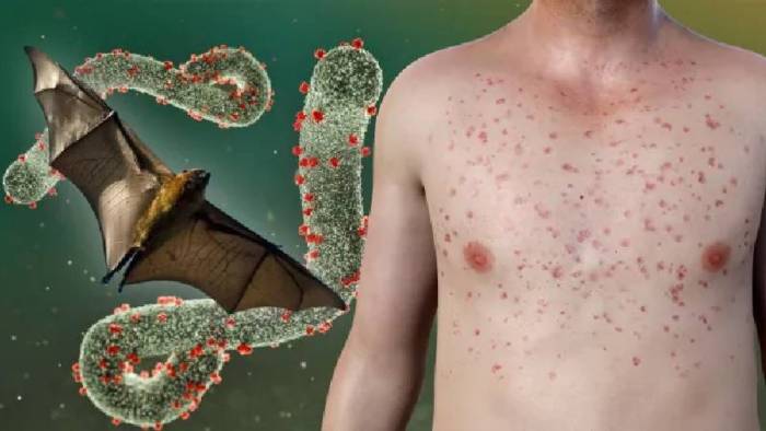 Marburg virüsü: Dünyanın en ölümcül virüsü yayılıyor ve tedavisi yok